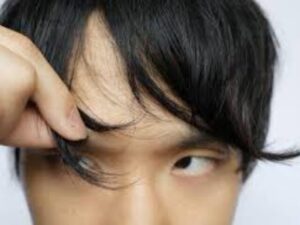 前髪が割れるのはM字ハゲの前兆？