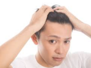 前髪が割れるのはM字ハゲの前兆？