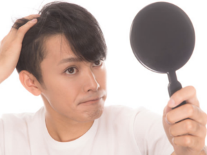 若ハゲは何歳から何歳まで