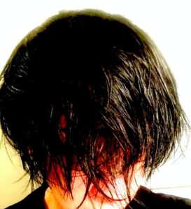 AGAスキンクリニック30代男性の体験談！