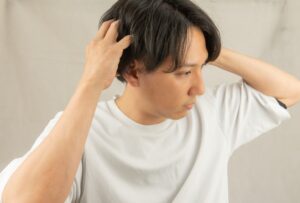 AGA治療初期脱毛はどれくらい抜ける？
