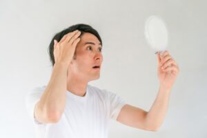 はげに人権なしは本当？