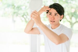 はげに人権なしは本当？